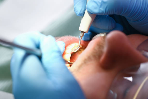 Best Emergency Treatment for Jaw Pain or Injury in Round Lake Heights, IL